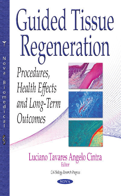 Guided Tissue Regeneration