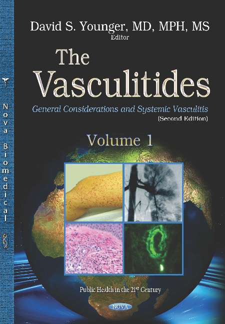 The Vasculitides