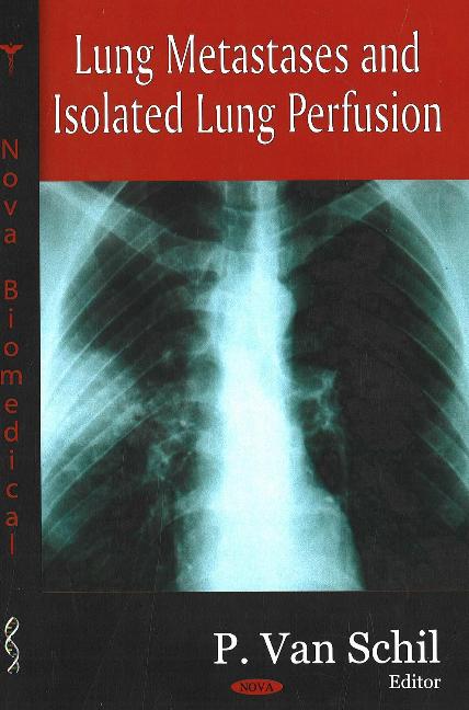 Lung Metastases & Isolated Lung Perfusion