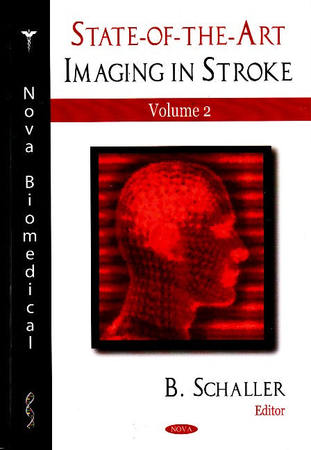 State-of-the-Art Imaging in Stroke