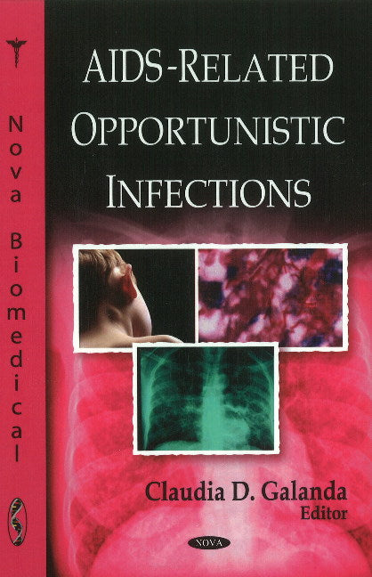 AIDS-Related Opportunistic Infections