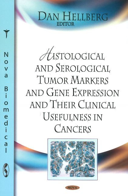 Histological & Serological Tumour Markers & Gene Expression & Their Clinical Usefulness in Cancers