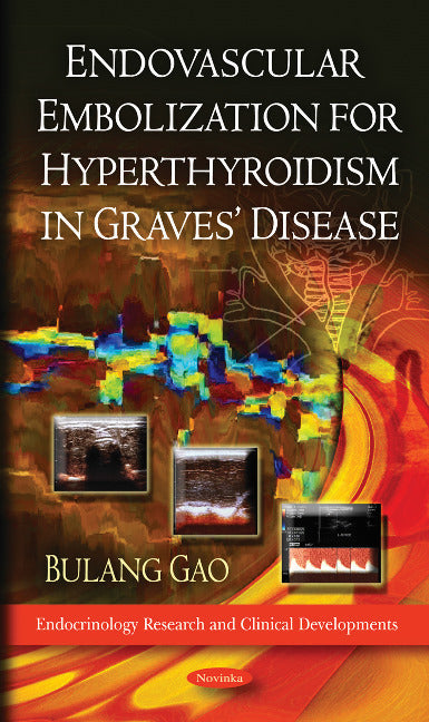 Endovascular Embolization for Hyperthyroidism in Graves' Disease