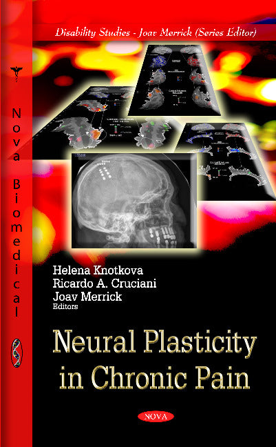 Neural Plasticity in Chronic Pain