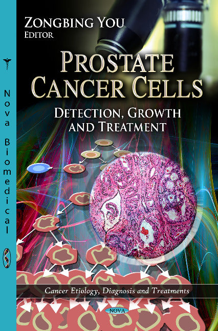 Prostate Cancer Cells