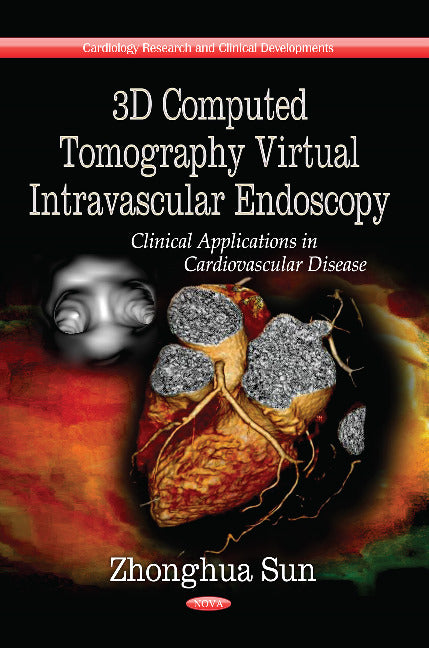 3D Computed Tomography Virtual Intravascular Endoscopy