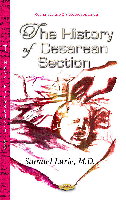 History of Cesarean Section