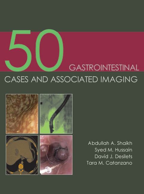 50 Gastrointestinal Cases & Associated Imaging