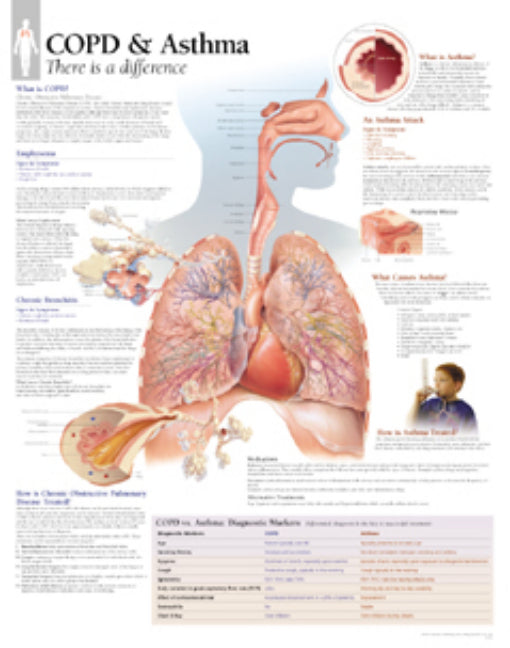 COPD & Asthma Laminated Poster