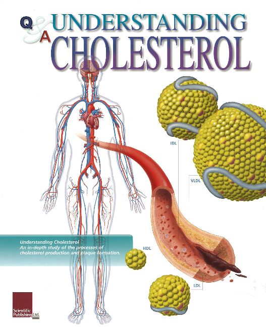 Understanding Cholesterol Flip Chart
