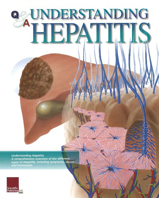 Understanding Hepatitis Flip Chart