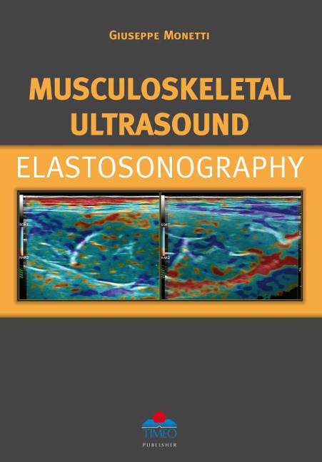 Musculoskeletal Ultrasound Elastosonography